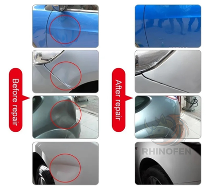 Kit Desabollador Ventosa Reparación Golpes Abolladuras Autos
